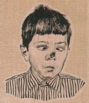 Boy With Fly On Nose 2 1/2 x 2 3/4-0